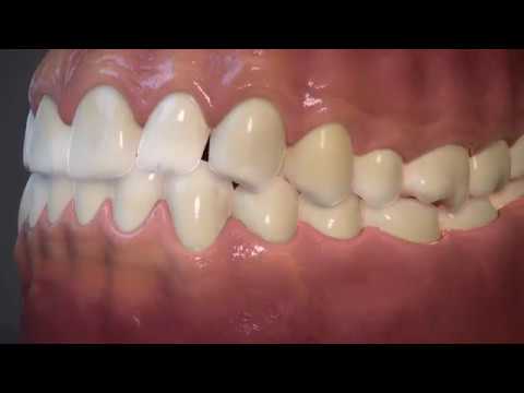 Teeth turning MP youtube